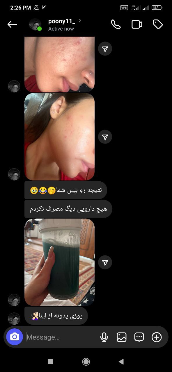 اسکرینشات نظر احمد درباره ماچا